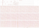 Burdick Mortara ELI 310/320 #007944 Red Grid Chart Paper